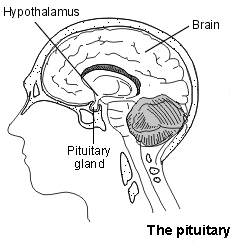 Prolactinoma: The pituitary
