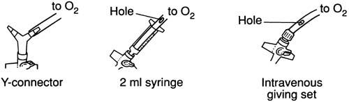 CRICOTHYROIDOTOMY (2)