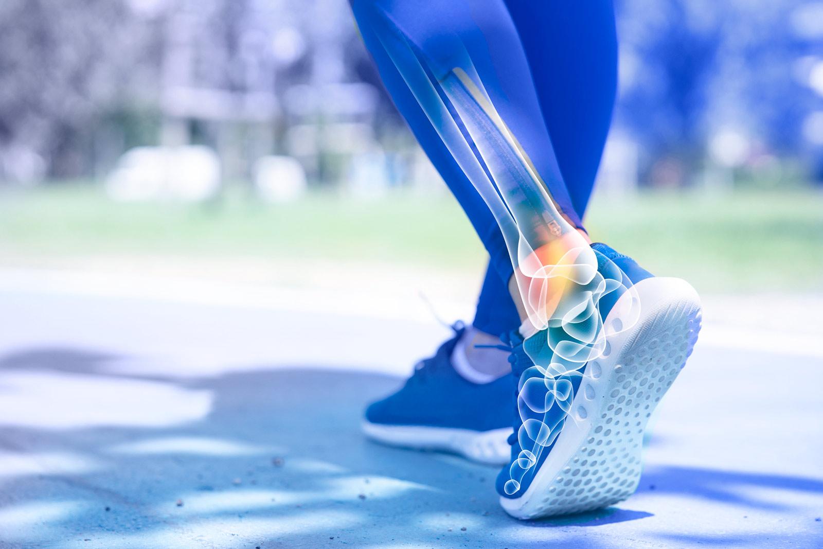 Runner in blue leggings with digital overlay showing ankle bone structure and potential injury point highlighted in orange.