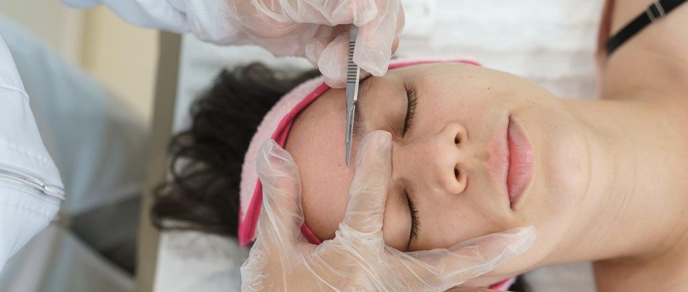 How safe is dermaplaning?