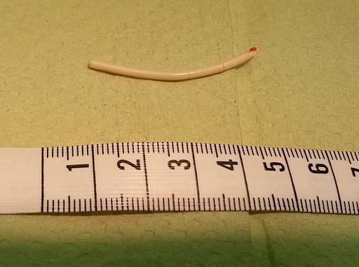 contraceptive implant Implanon