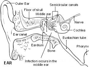 The ear showing otitis media