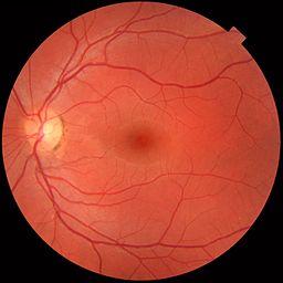Fundus photo of normal left eye