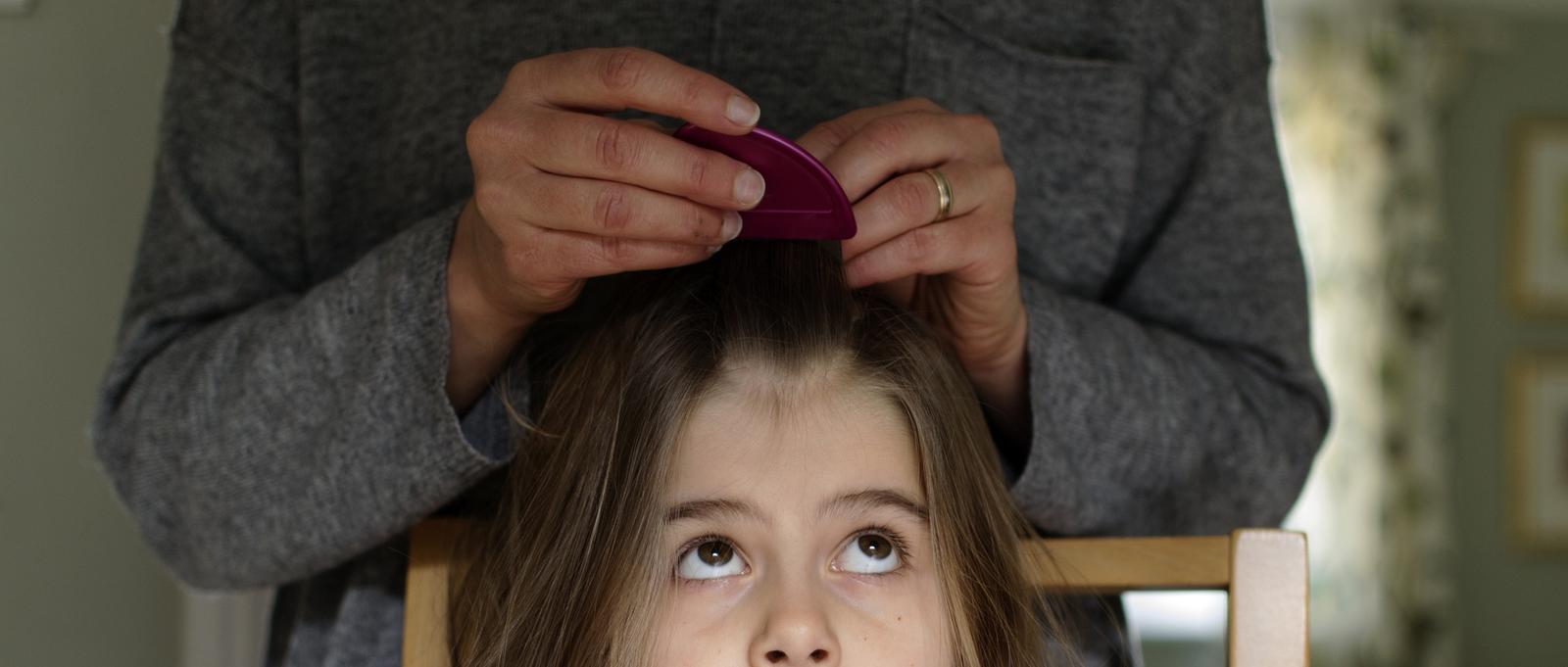 The best ways to get rid of head lice