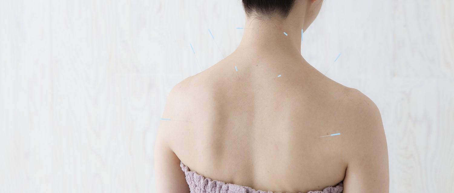 Can acupuncture help you get pregnant?
