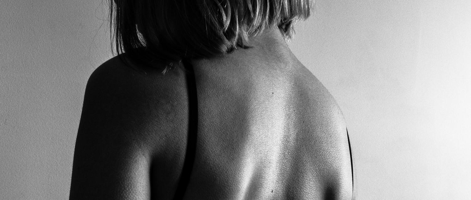 psoriasis and depression