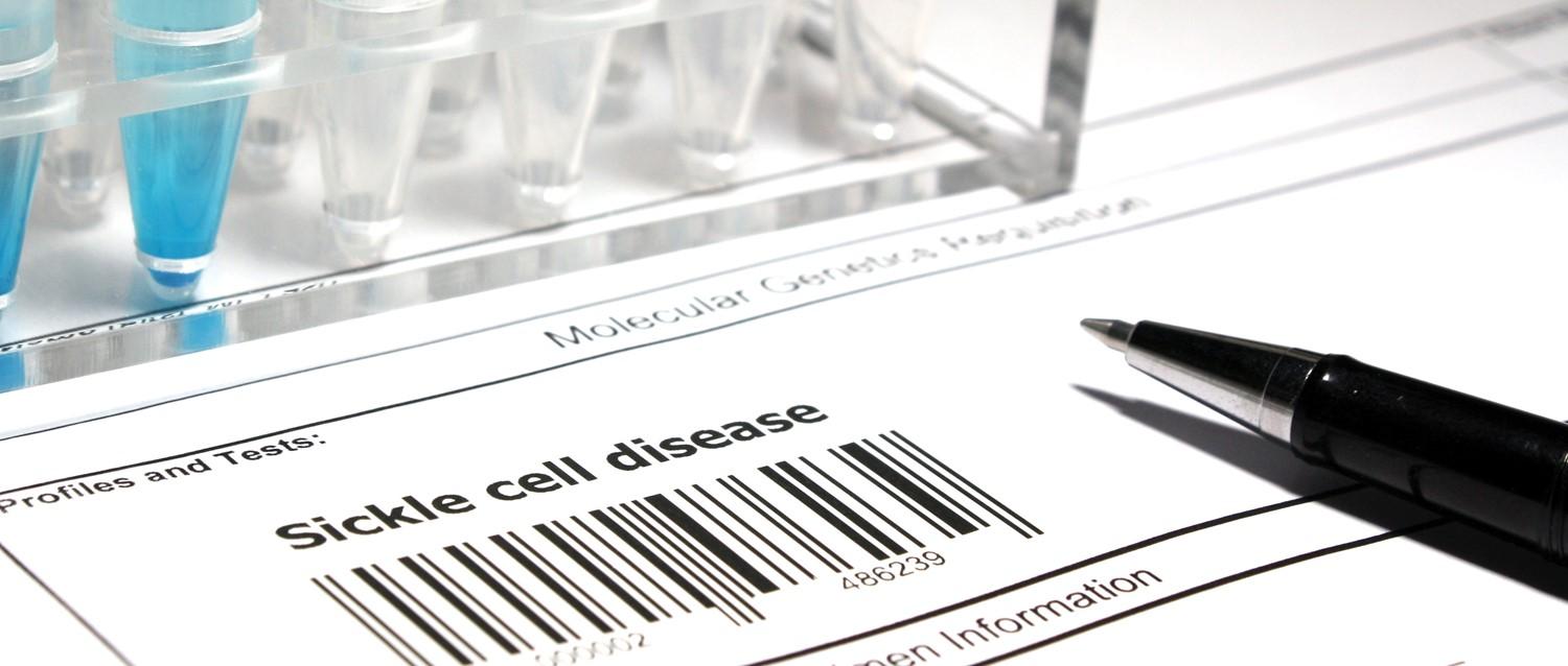 What does the new treatment for sickle cell disease mean for sickle cell patients?