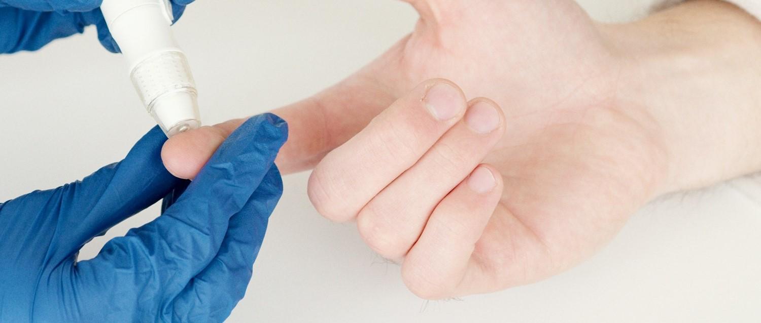 How do you know if you have HIV?