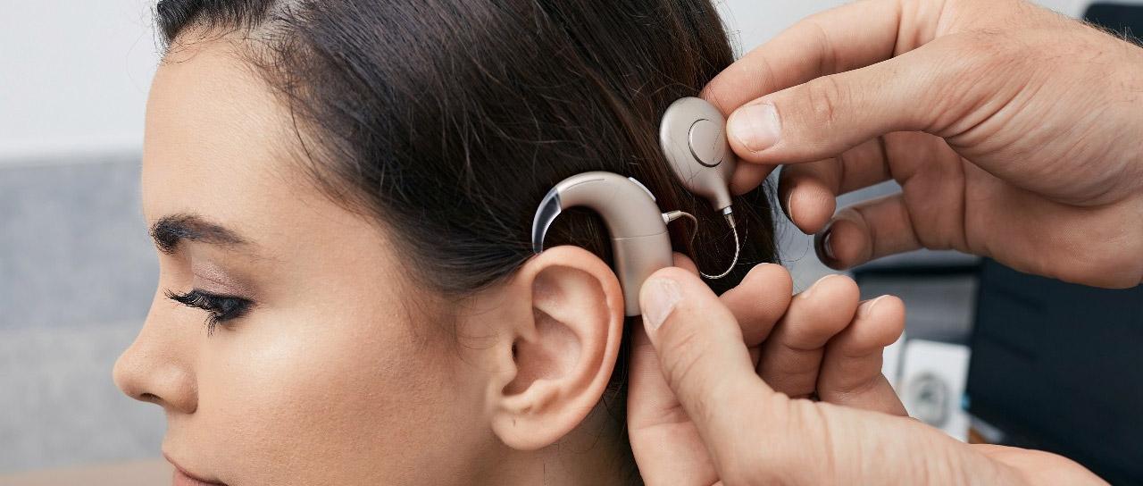 What is a cochlear implant and what effect do they have on hearing?