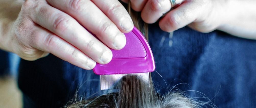 How to check your child for head lice and nits