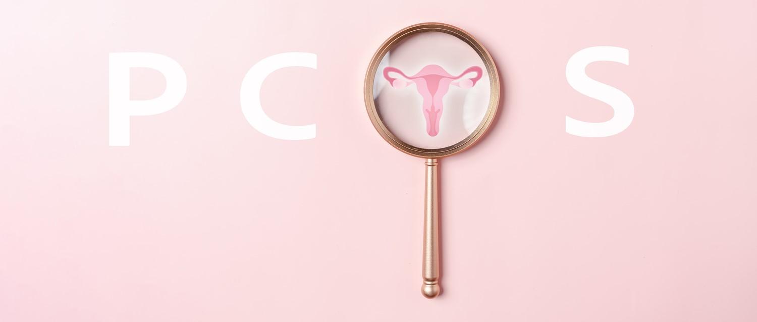 8 common myths about PCOS (Polycystic Ovary Syndrome)